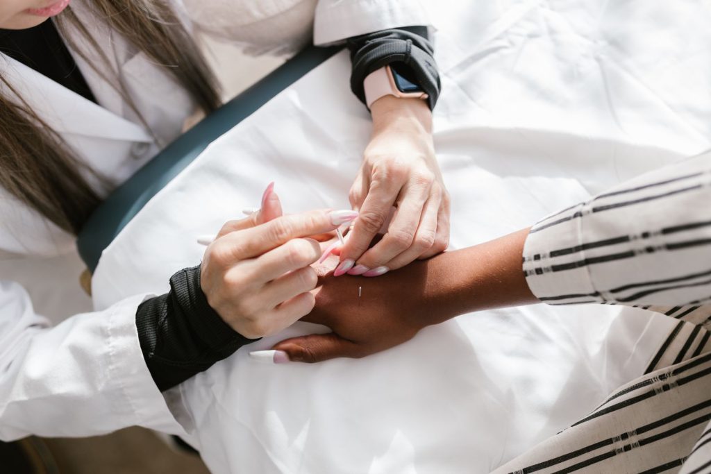 Les aiguilles d&rsquo;acupuncture : matériau, taille et usage unique