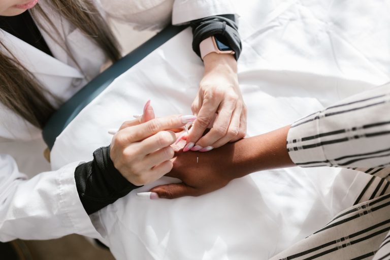 Les aiguilles d&rsquo;acupuncture : matériau, taille et usage unique
