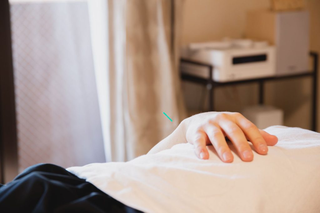 Qu&rsquo;est-ce que l&rsquo;acupuncture ? Origines et définition